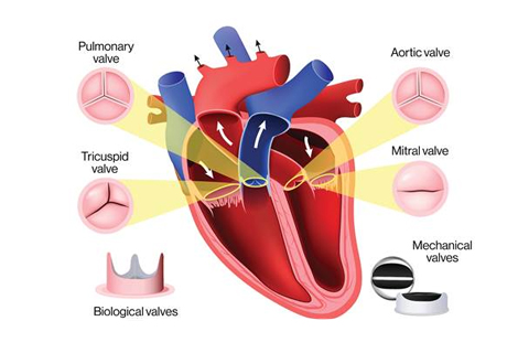 Valvular Disease